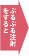 ぷるぷる注射をすると