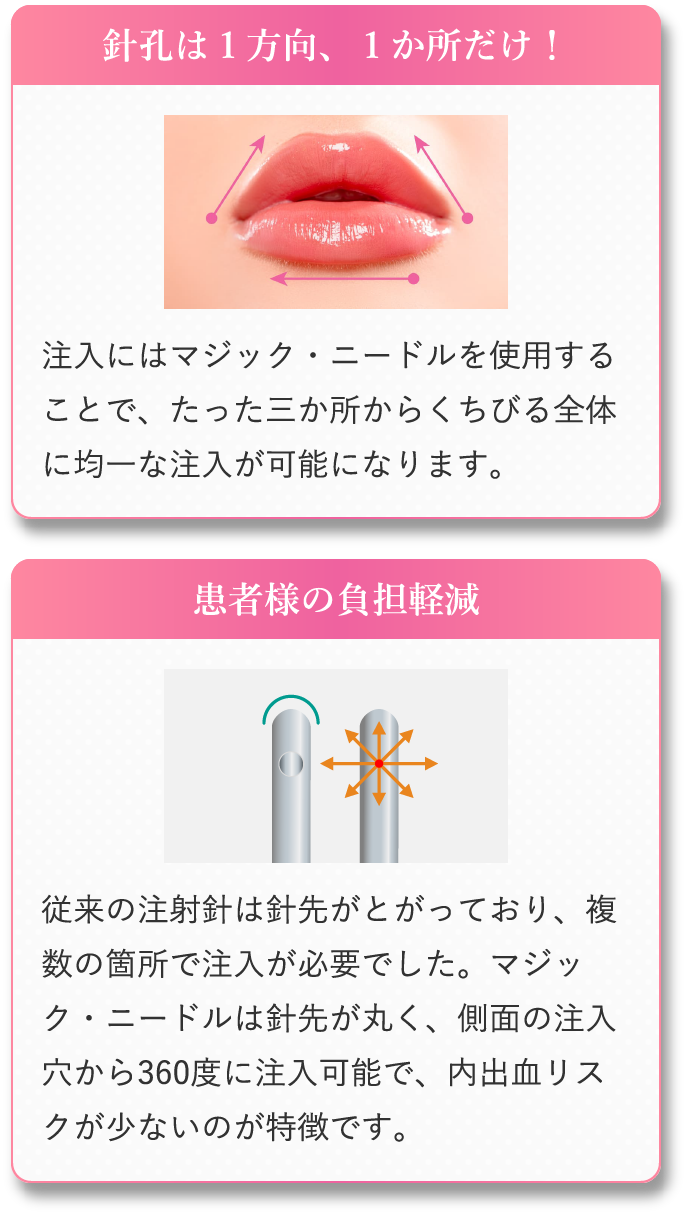 針孔は１方向、１か所だけ！ 患者様の負担軽減