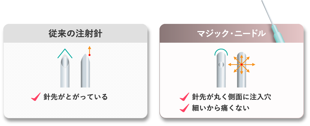 従来の注射針 マジック・ニードル