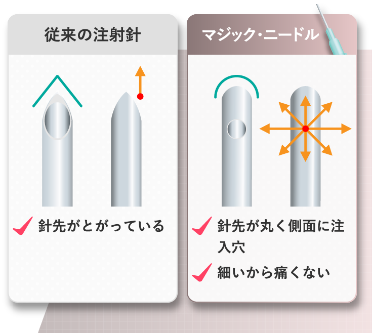 従来の注射針 マジック・ニードル