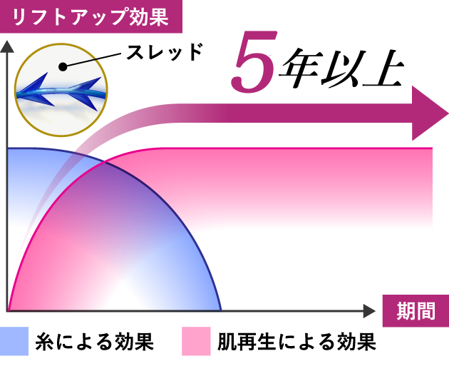 ぷるぷるスレッドがスゴイ理由 3