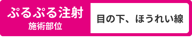 ぷるぷる注射施術部位：目の下、ほうれい線