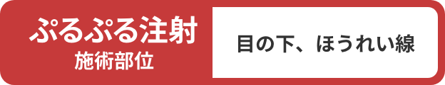 ぷるぷる注射施術部位：目の下、ほうれい線