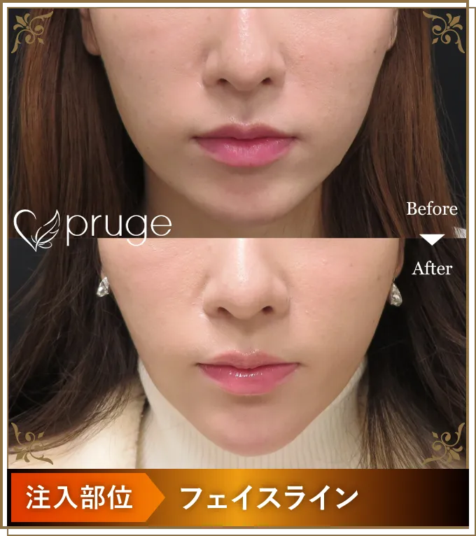 Before After