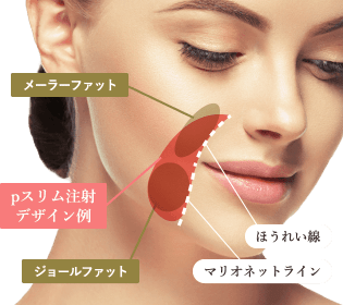 お顔のpスリム注射のデザイン例