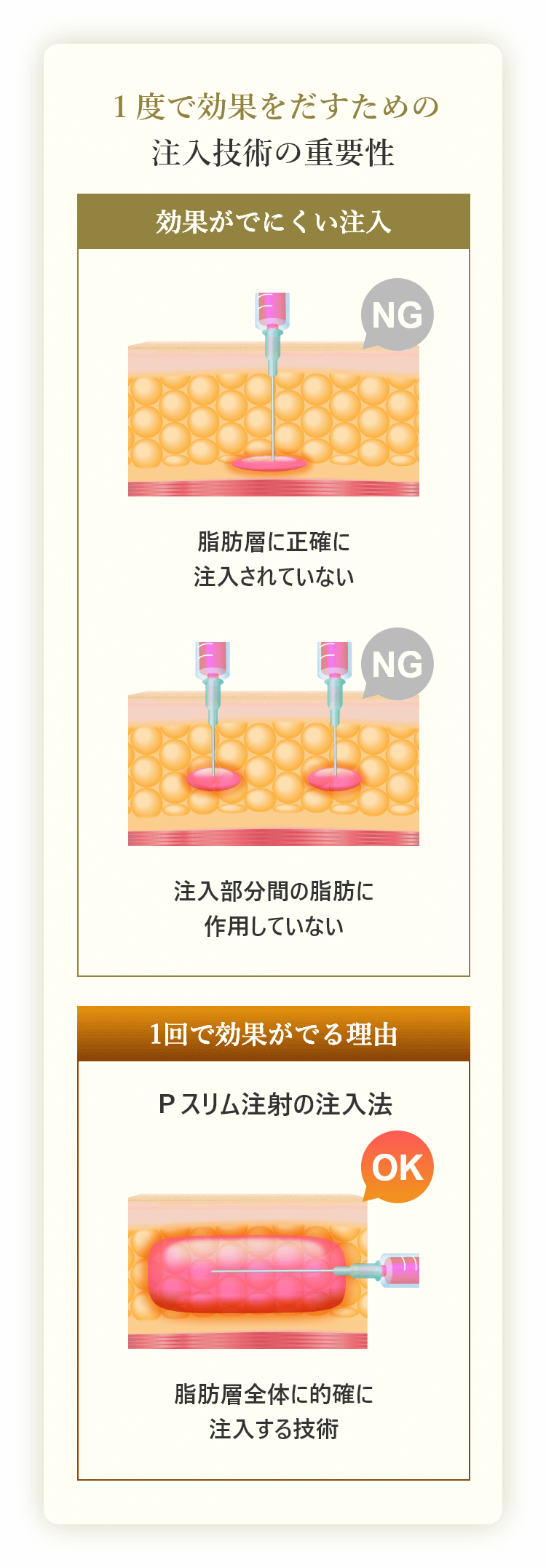 １度で効果をだすための注入技術の重要性