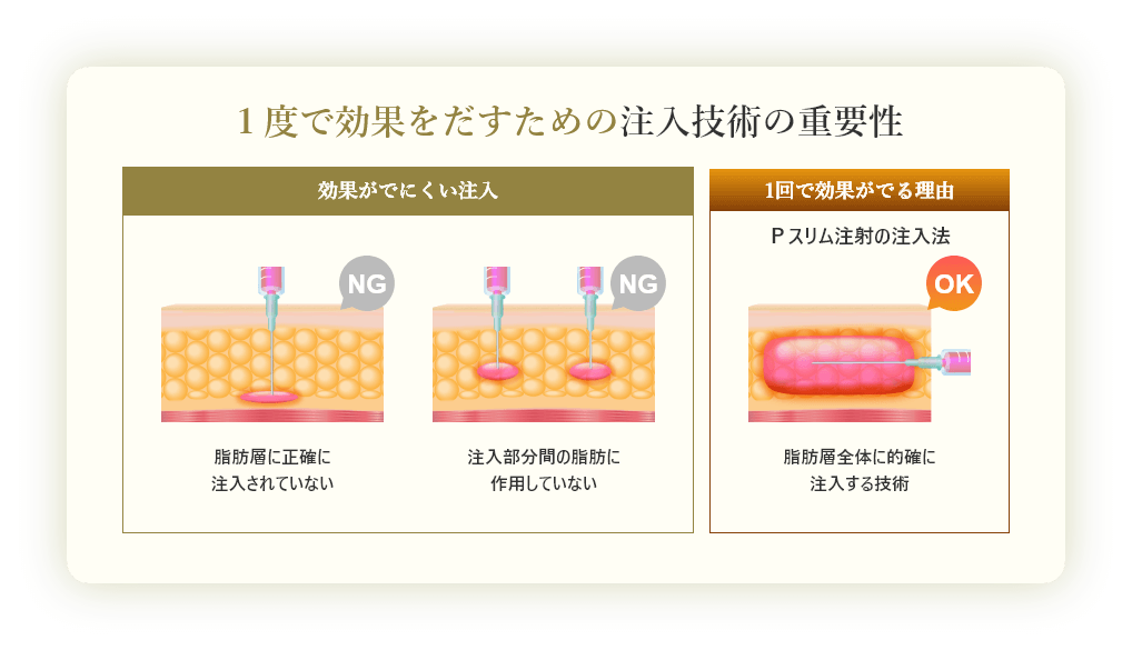 １度で効果をだすための注入技術の重要性