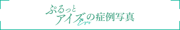 ぷるっとアイズの症例写真