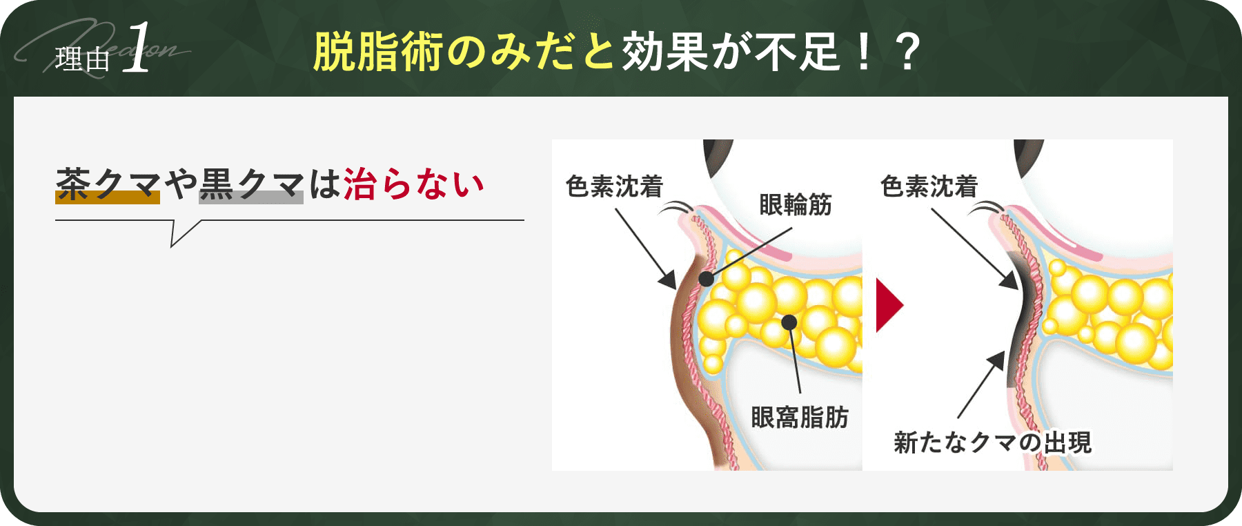 茶クマや黒クマは治らない