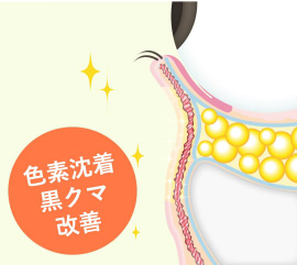 Step 3 ふくらみがなくなり、色素沈着や黒クマも皮膚再生効果により改善される