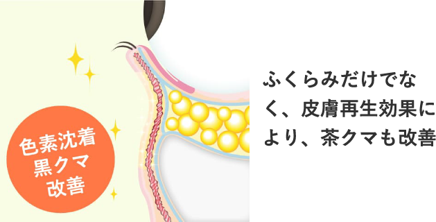 Step 3 ふくらみがなくなり、色素沈着や黒クマも皮膚再生効果により改善される