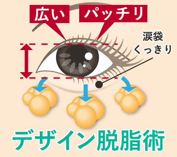 「デザイン脱脂術」により目の開きが自然に最大化し、瞳の存在感アップ！