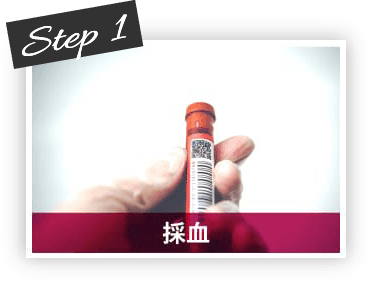 Step1 採血