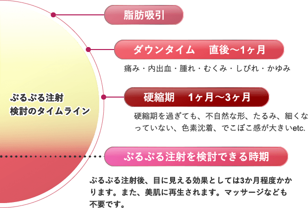 ぷるぷる注射検討のタイムライン