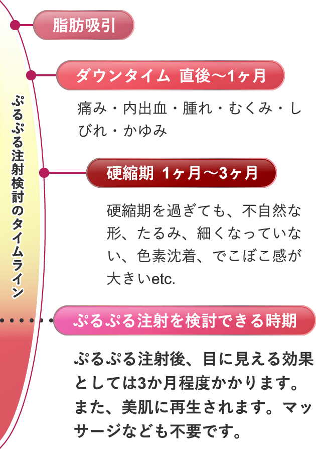 ぷるぷる注射検討のタイムライン