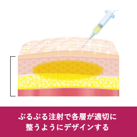 ぷるぷる注射で各層が適切に整うようにデザインする