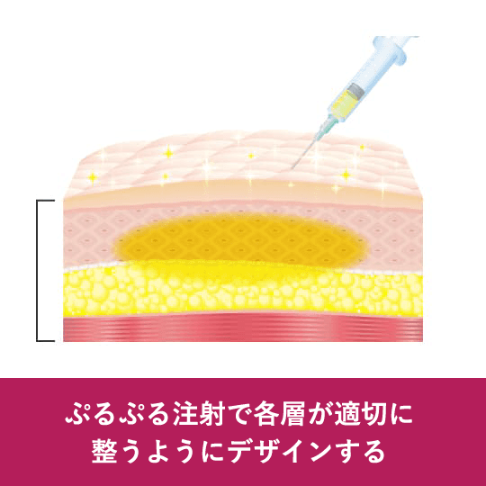 ぷるぷる注射で各層が適切に整うようにデザインする