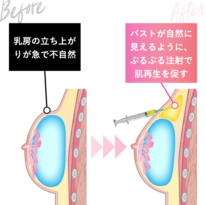 不自然な浮き上がり